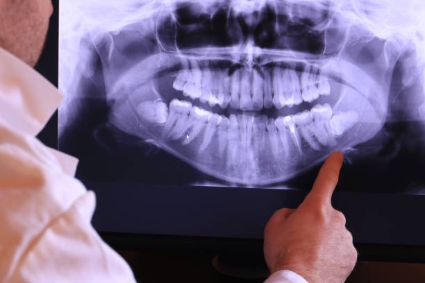 Best Emergency Denture Repair in Maplewood, MN